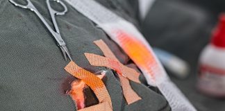 Odszkodowanie za uszczerbek na zdrowiu