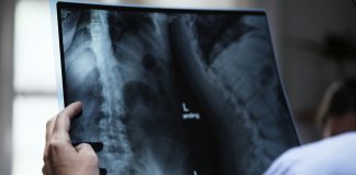 Na jakiej drodze najlepiej dochodzić odszkodowania za błąd medyczny?