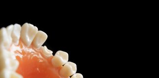 Dlaczego leczenie krzywego zgryzu jest takie ważne? Poznaj zdanie ekspertów na temat zabiegów ortodontycznych