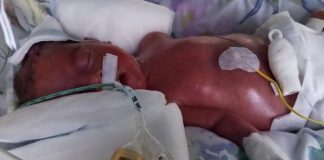 Marysia z Kozłowa potrzebuje naszego wsparcia!